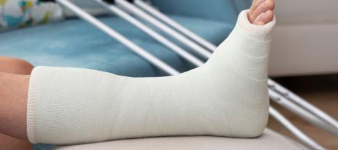 person wearing cast on leg resting on furniture